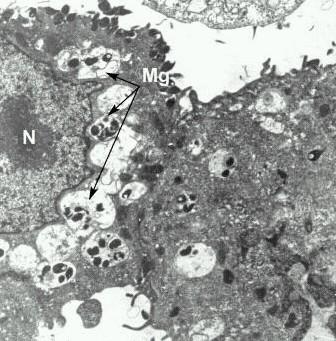 10 Pri izolaciji mikoplazem v celični kulturi Vero, so Jensen in sod. preučevali morfologijo danskega seva M. genitalium M2300 z elektronskim mikroskopom. Izkazalo se je, da M.