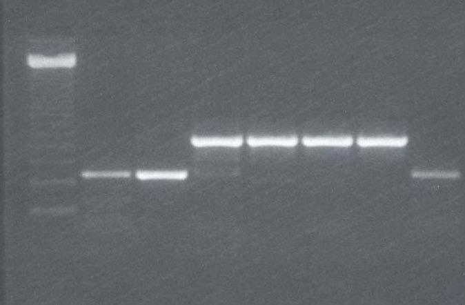 47 V preglednici 4 so prikazani dobljeni rezultati. Z metodo PCR smo z reagenti Sacace Biotechnologies Srl, Italija testirali 88 vzorcev. DNK M.