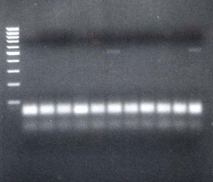 280 bp 550 bp (IC) Slika 17: Gelska elektroforeza pridelkov verižne reakcije s polimerazo (PCR) Mycoplasma genitalium s kompletom reagentov Mycoplasma genitalium 280/550 IC (Sacace Biotechnologies
