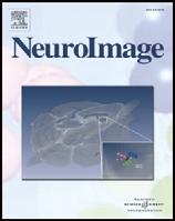 NeuroImage 43 (2008) 368 378 Contents lists available at ScienceDirect NeuroImage journal homepage: www.elsevier.