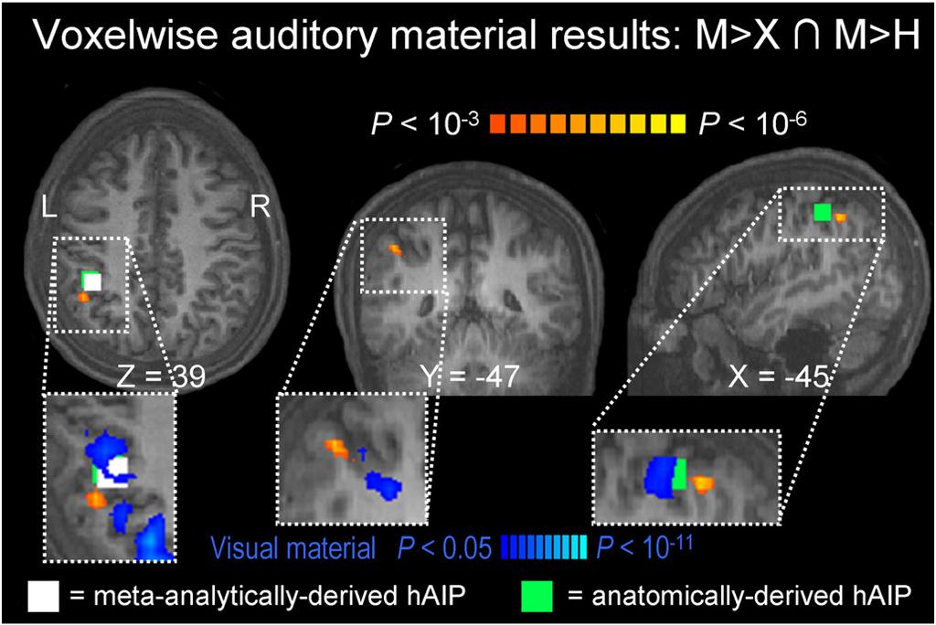 374 S.R. Arnott et al. / NeuroImage 43 (2008) 368 378 Fig. 4. Voxel-wise auditory material-processing conjunction analysis in the neurologically intact group showing left inferior parietal lobe (L IPL) activation.
