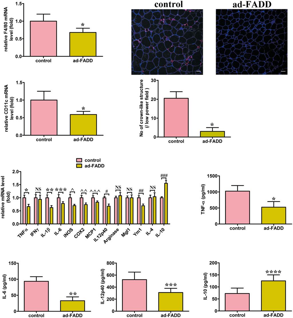 Hongqin Zhuang et al FADD S191D mutation or deficiency prevents obesity EMBO Molecular Medicine A B C D E F G H Figure 9. Decreased adipose tissue inflammation in ad-fadd mice.