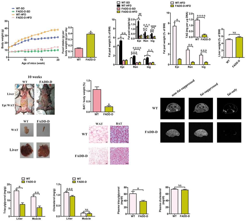 Hongqin Zhuang et al FADD S191D mutation or deficiency prevents obesity EMBO Molecular Medicine A C B D E F G H Figure 2. Body weights and metabolic phenotype of FADD-D mice.