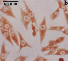 immunocytochemical staining O ~ P