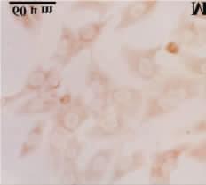 immunocytochemical staining MG-63