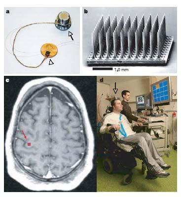Repair: Brian-triggered spinal stimulation Chet Moritz, Ph.D.