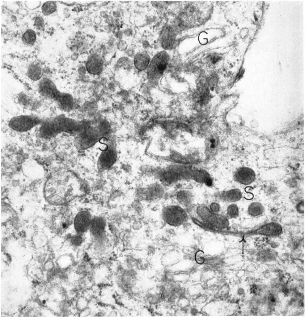 The preparations were sectioned with an LKB ultrotome and then stained with uranyl acetate. An RCA EMU 3F electron microscope was used to examine the grids.