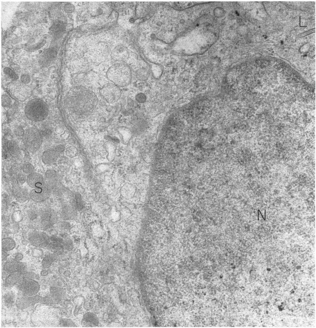 N, nucleus. >< 0,068 dna. There is a resemblance to "lysosomes" which are known to be present in Langerhans cells.