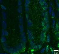 immunofluorescence in samples of mice exposed to