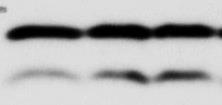 (F) and ps6 were analyzed in SW480 cellstreated with, plus rapamycin (200 nm) and plus kt InhibVIII (2.12µM).