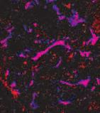 (d) Confocal imaging of transgenic mouse glomeruli showing