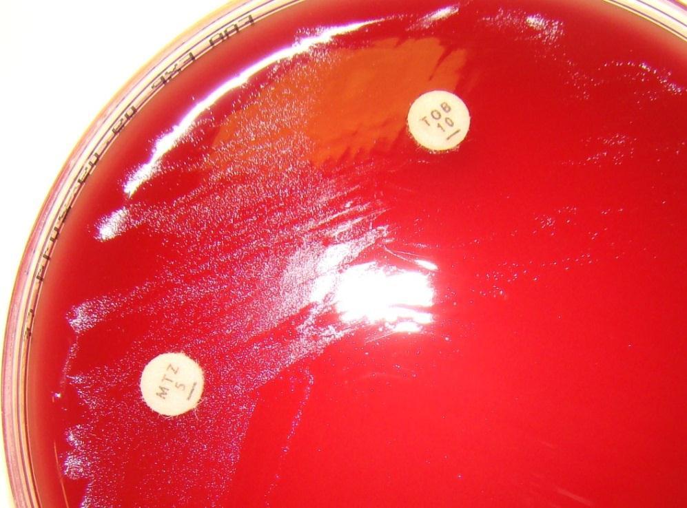 Specimen 33/2014. Piece of cardiac valve. Primary anaerobic culture Growth on anaerobic blood agar plate (FAA) at 35 C, after 48 hours.