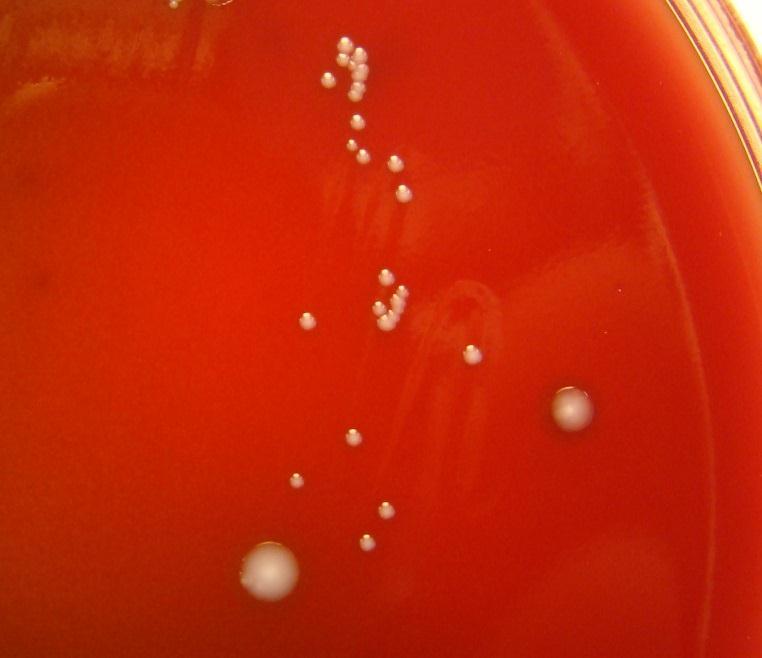 3 days 4 days Growth on streptococcal sheep blood agar plate