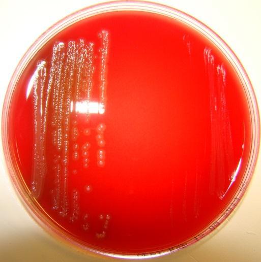Specimen 34/2014 Aerotolerance tests Blood agar: aerobic; chocolated