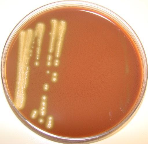 Left: The bacterium is growing on all three plates.