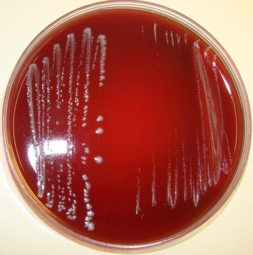 (Streptococcus viridans). 2.