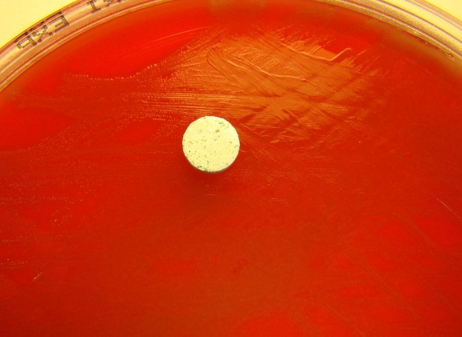 agar plate at 35 after 24 hours.