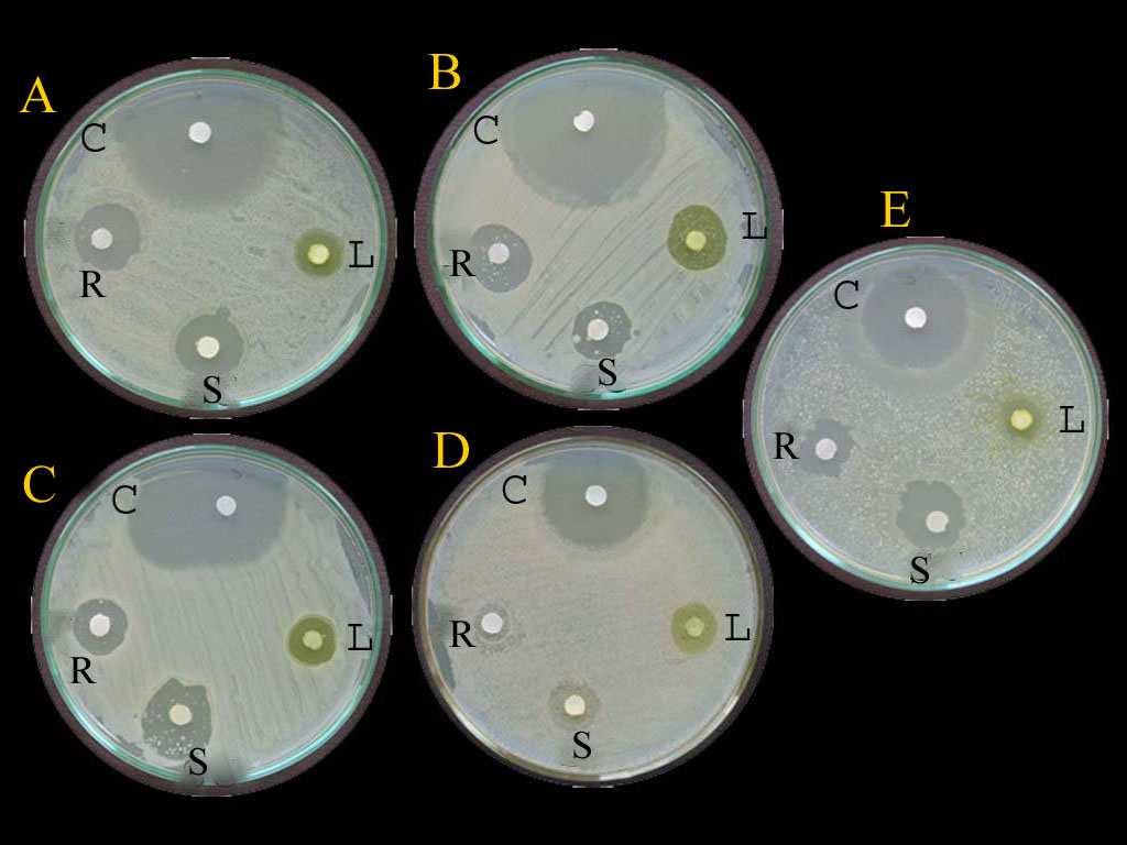 Fig. 7: Antibacterial activity of Eclipta prostrata. (Methanolic extract) A-higella boydii; B- E.