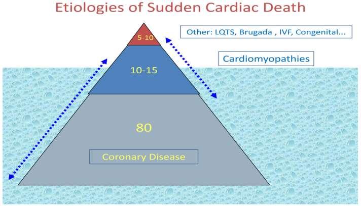 Sudden Cardiac Death (SCD) Aborted Cardiac Arrest (ACA) USA: 350,000-400,000