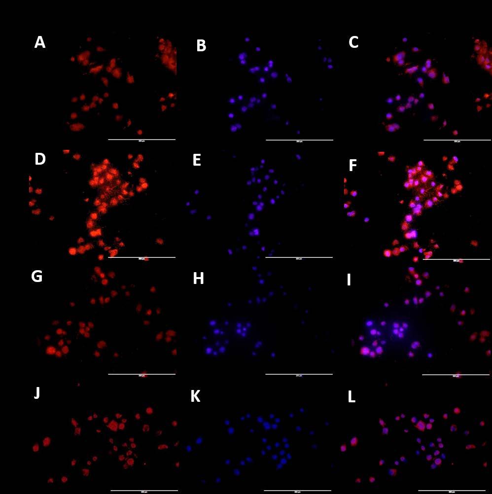 Figure 44: Immunofluorescence staining for effect of IL-1β and vitamin D on Cyp24A1 in HepG-2 cells.
