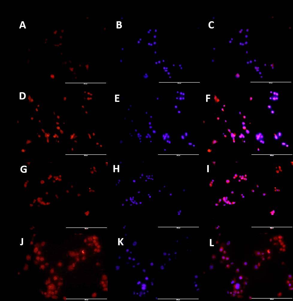 Figure 46: Immunofluorescence staining for effect of IL-1β and vitamin D on Cyp27B1 in HepG-2 cells.