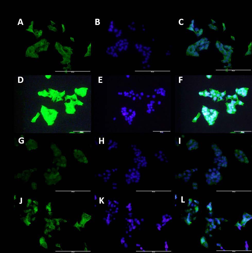 Figure 50: Immunofluorescence staining for effect of IL-1β and vitamin D on Importin α3 in HepG-2 cells.