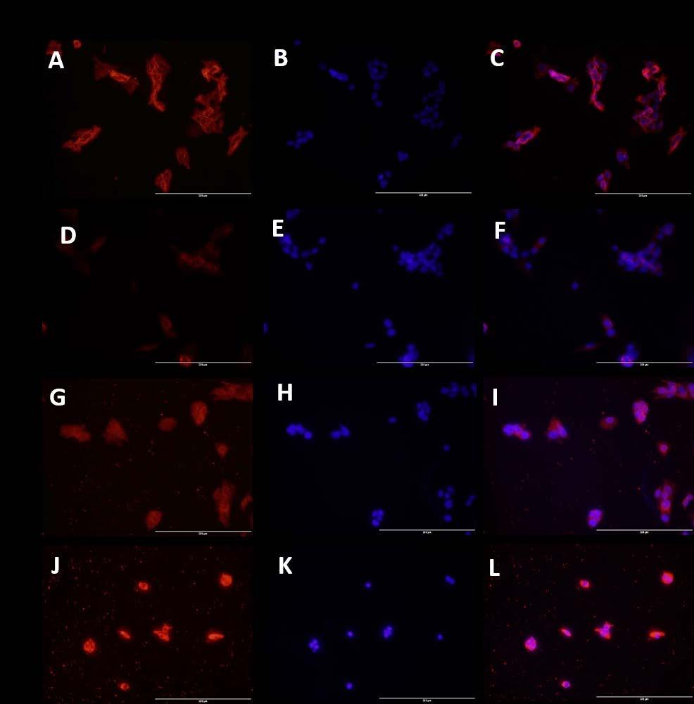 Figure 2: Immunofluorescence staining for effect of TNF-α and vitamin D on VDR in HepG-2 cells.