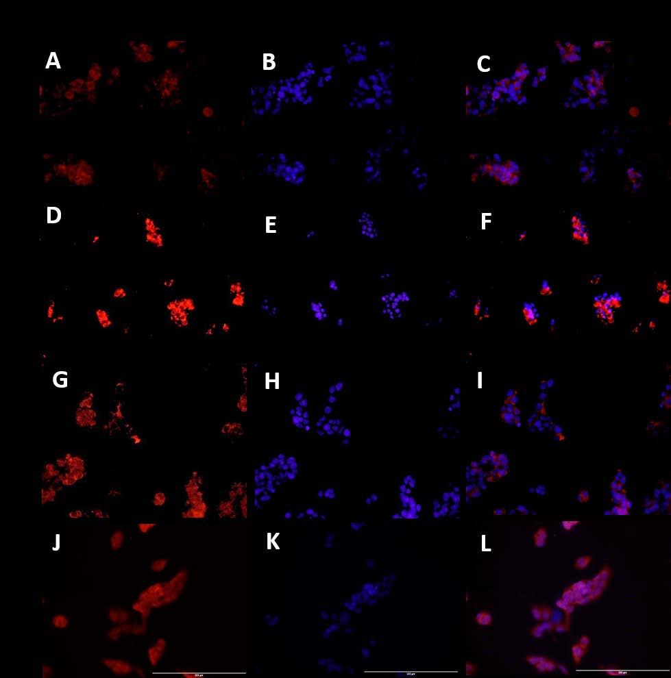 Figure 4: Immunofluorescence staining of the effects of TNF-α on Cyp24A1 in HepG-2.