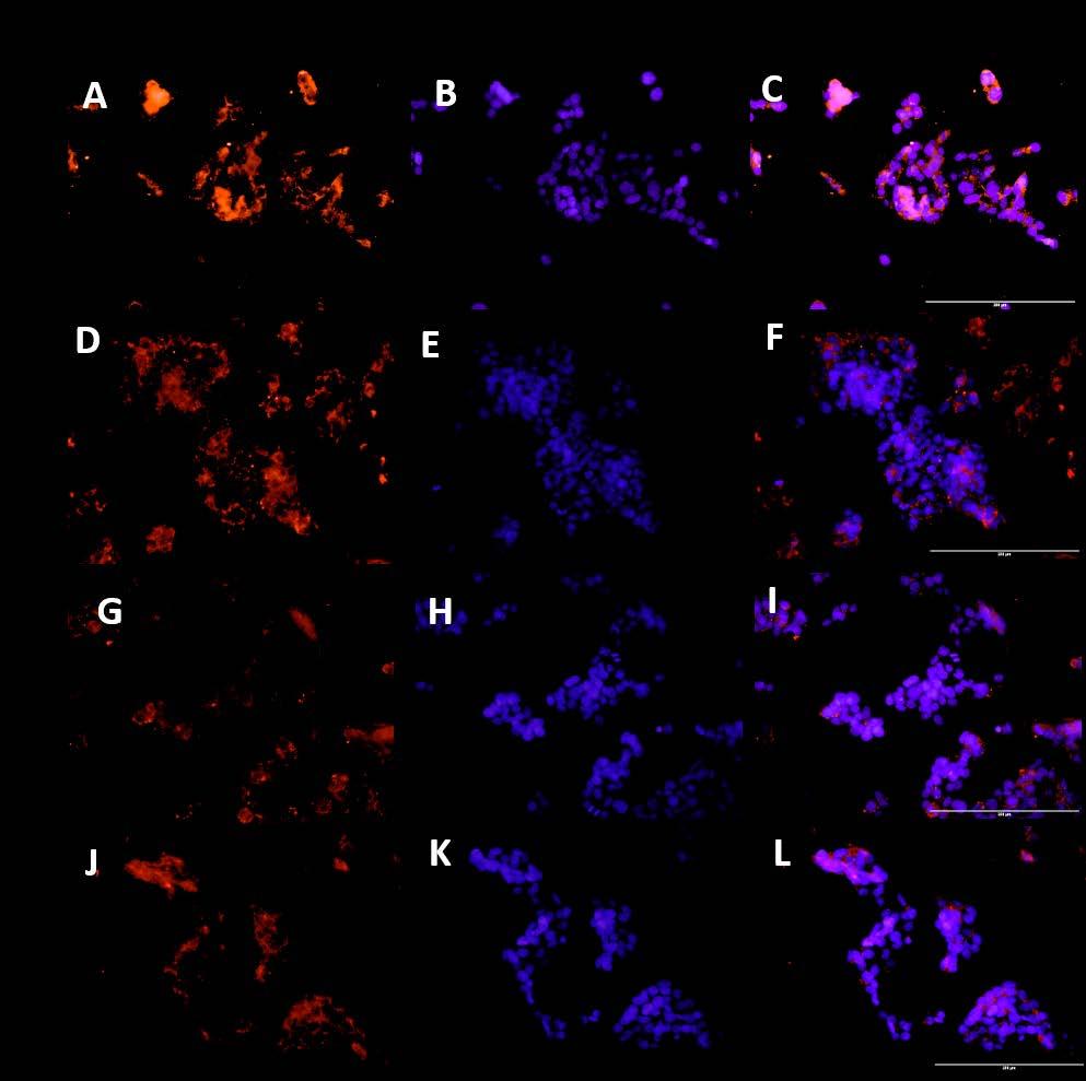 Figure 6: Immunofluorescence staining of the effects of TNF-α on Cyp27B1 in HepG-2 Immunofluorescence studies were completed for the expression of cyp27b1 in HepG-2 cells after treating cells with
