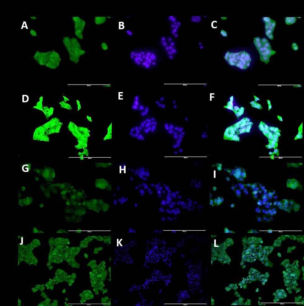 Figure 8: Immunofluorescence staining for the effects of TNF-α on importin α3 in HEPG-2 Immunofluorescence studies were completed for the expression of importin α3 in HepG-2 cells after treating the