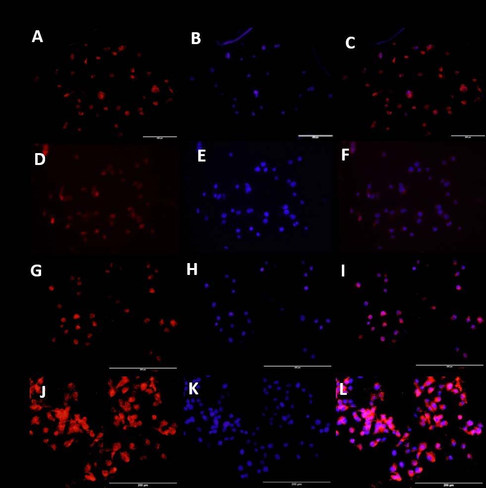 Figure 16: Immunofluorescence staining for effect of IL-6 and vitamin D on Cyp27B1 in HepG-2 cells.