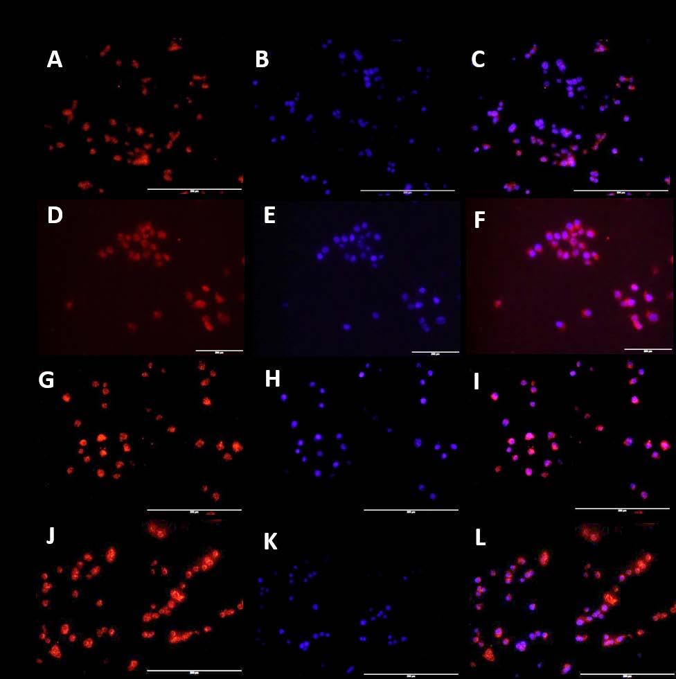Figure 24: Immunofluorescence staining for effect of IL-8 and vitamin D on Cyp24A1 in HepG-2 cells.