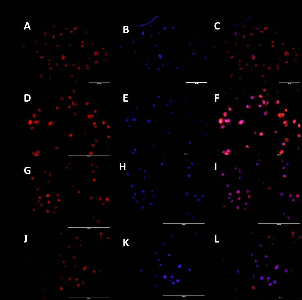 Figure 26: Immunofluorescence staining for effect of IL-8 and vitamin D on Cyp27B1 in HepG-2 cells.