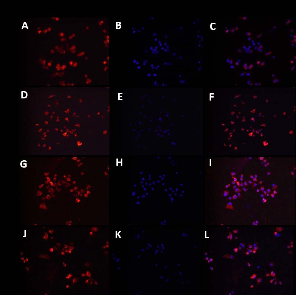 Figure 32: Immunofluorescence staining for effect of IL-10 and vitamin D on VDR in HepG-2 cells.