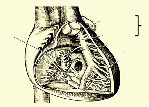 8 K. Takigiku Inflow septal Subpulmonary Outlet muscular Perimembranous Doubly committed Trabecular Inlet muscular Fig. 1.