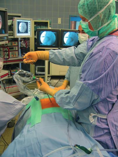 Minimally invasive techniques can reduce tissue damage and its consequences. Endoscopic surgeries demonstrate advantages which have raised these procedures to the standard in various medical areas.