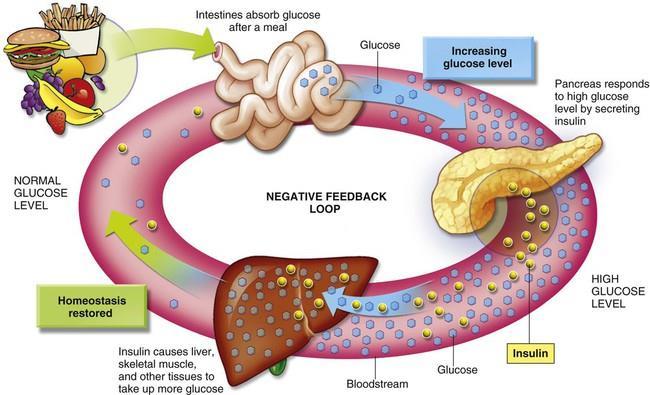 Long term metabolic effects of noise Type 1 Diabetes Type 2 Diabetes