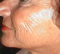 Bleaching cream Wrinkles