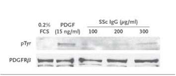 Scleroderma-derived Antibodies to the PDGF Receptor Stimulate Cell Signaling and Collagen Production IP: PDGF receptor