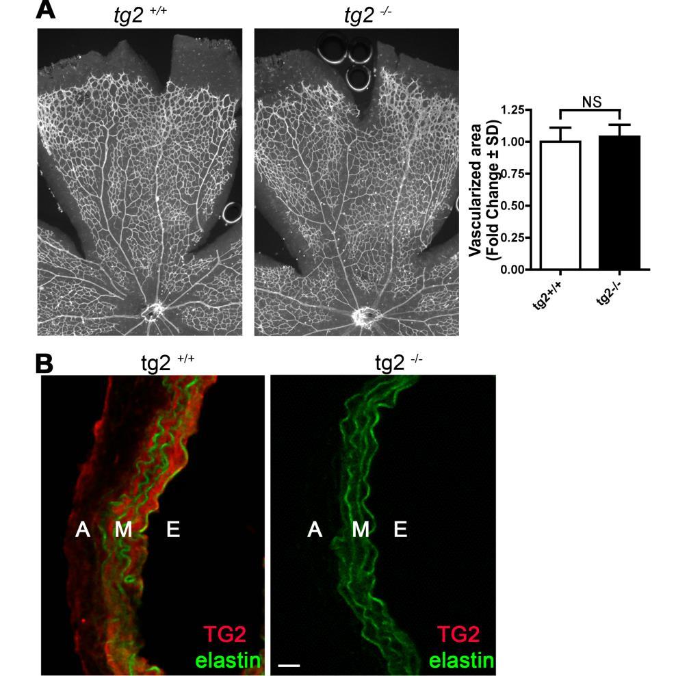 Fig. S1. Analysis of retinas and aortas from tg2 +/+ and tg2 -/- mice. (A) Confocal images of retina stained with isolectin-b4 from P7 mice.