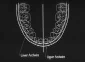 Most currently popular arch forms spring from three sources: Some orthodontic guru s idea of what is correct A catenary curve Shape of the end of an egg (trifocal ellipse) Solution: Orthos arch forms