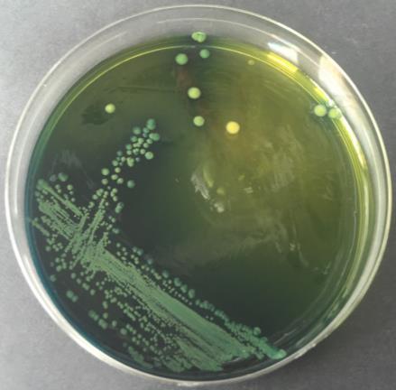 MRS agar (37 C, 48-72h) Purification of microorganisms: