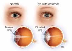 with only cones Visual acuity (sharpest vision) is here No photoreceptor cells are