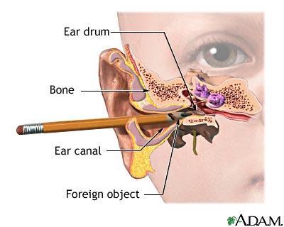 3 regions: Anatomy of the Ear External ear Detects sound waves towards
