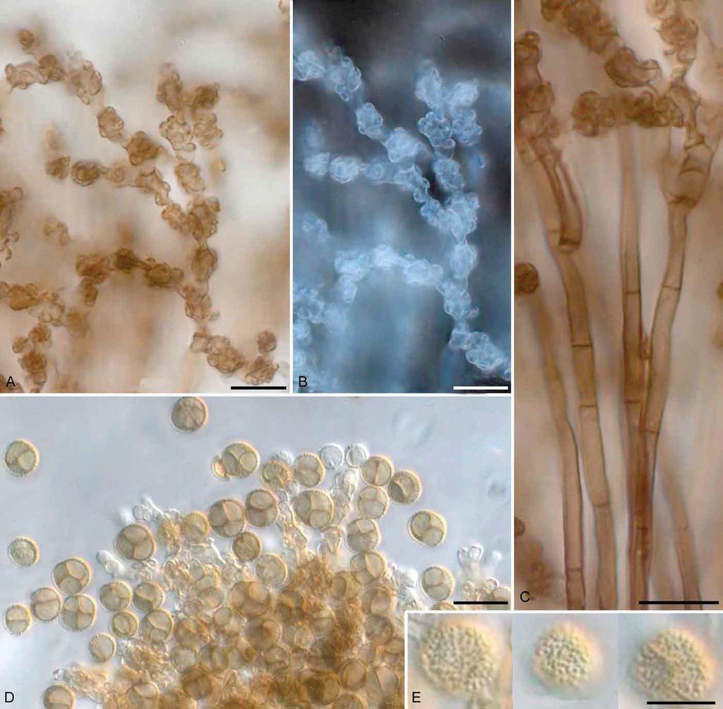Braunomyces dictyosporus gen. sp. nov. from Vietnam Fig. 2. Braunomyces dictyosporus (HAL 2606). A B. Monochasial branching of conidiogenous cells (B in dark eld). C.