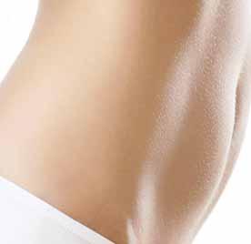 contouring and cellulite reduction treatments. 1. Enables total body contouring 2.