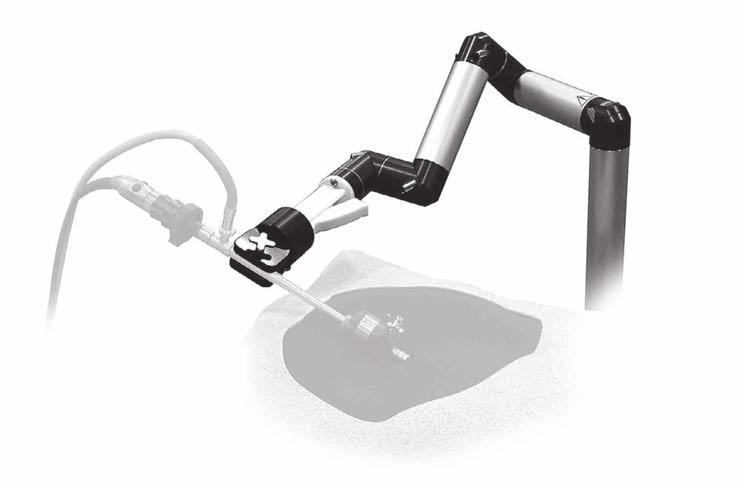 ENDOmotion System Mechanical Support Arm Instrumentation Laparoscopes ENDOmotion System Universal support arm for laparoscopy
