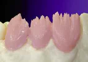 1 st dentine bake Mix the dentine and incisal powders together in the usual manner with the carving liquid provided.