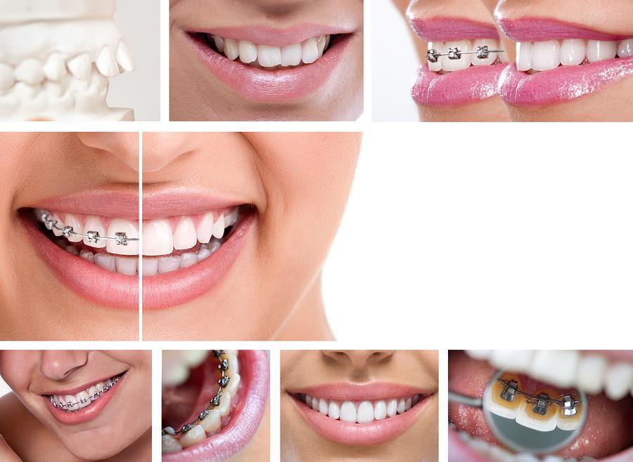 5 DO THEY OFFER A VARIETY OF TREATMENT OPTIONS? Some orthodontists are limited in treatment options, leaving patients with a feeling of defeat.