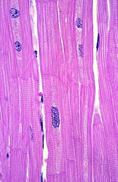 Cardiac muscle Consist of